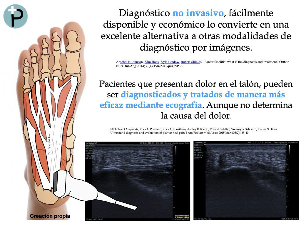 ecografia-como-herramienta-diagnostica