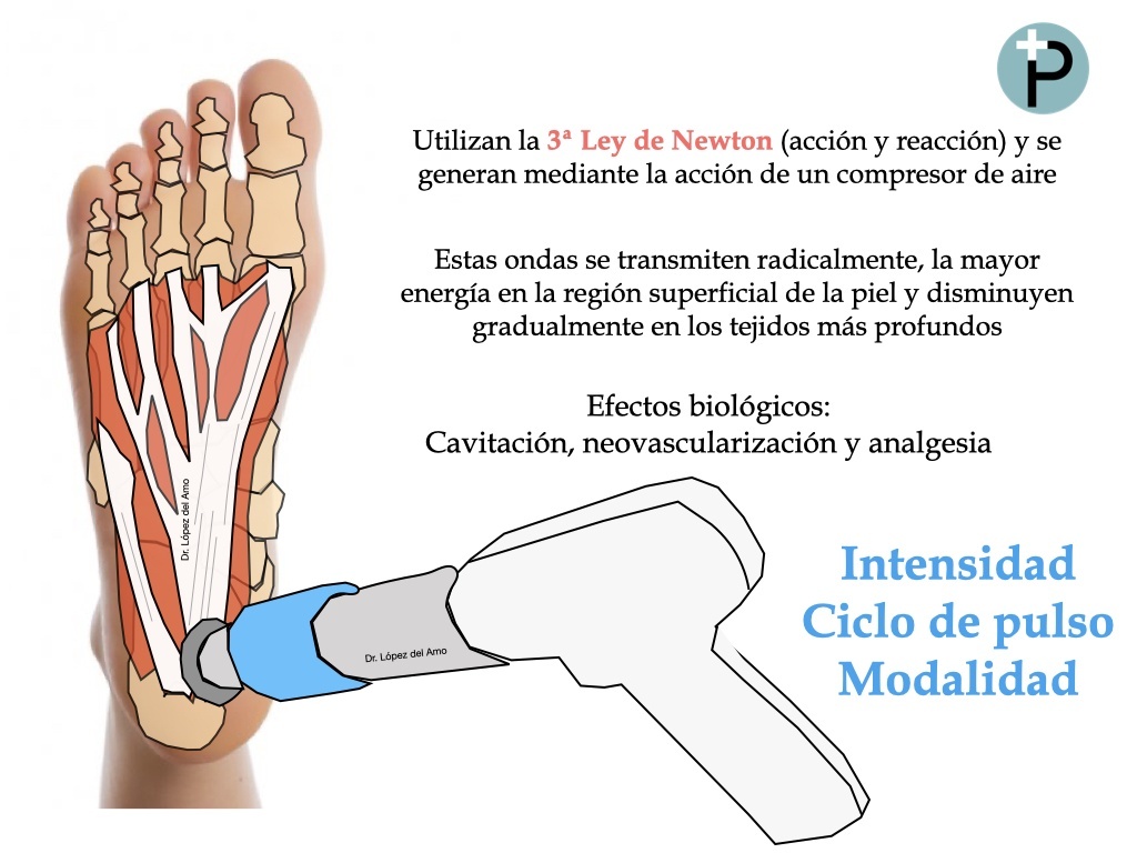 intensidad, ciclo de pulso y modalidad