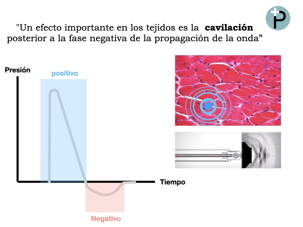 ondas-de-choque